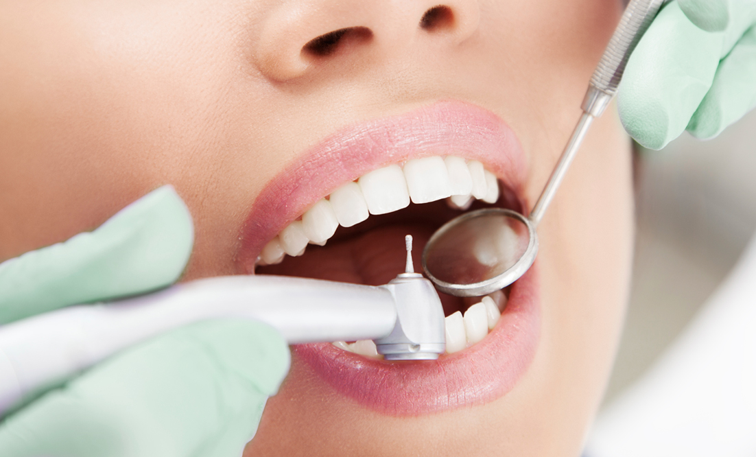 endodoncia-2